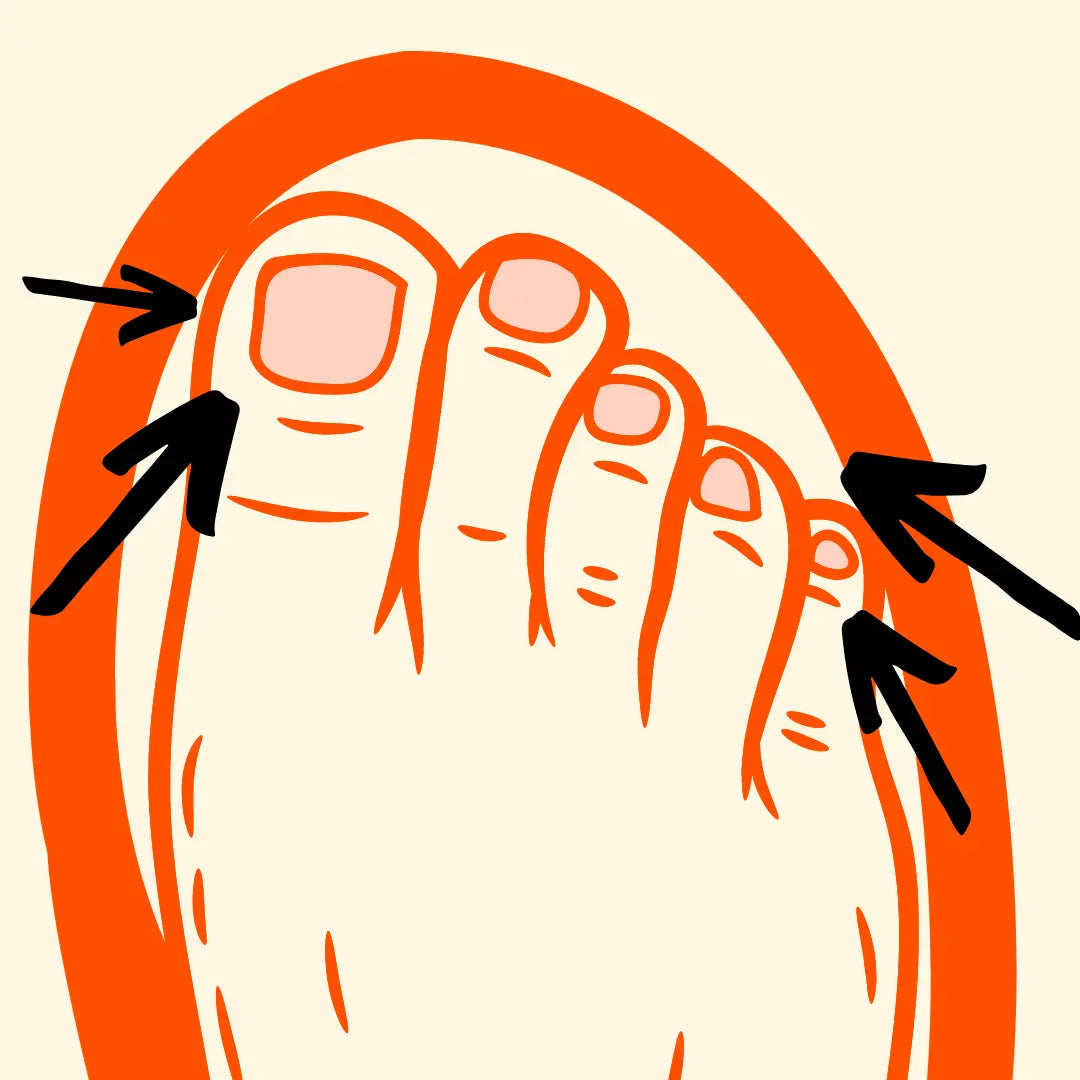 An illustration of feet in cramped shoes without wearing toe spacers